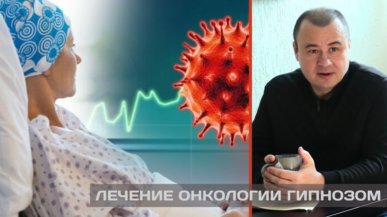 Гипноз - онкология